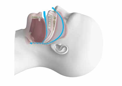 apneja snoring